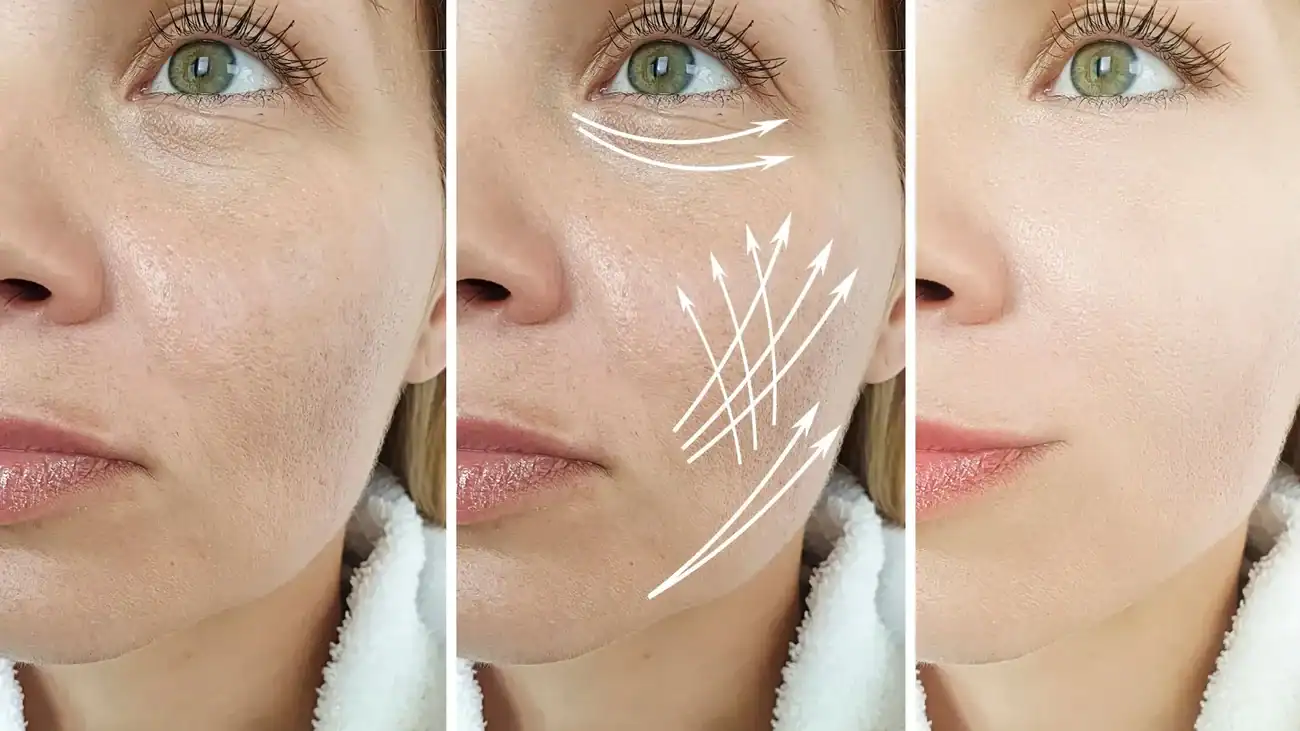 Can One Treatment Really Tackle More Than One Skin Concern Theale?