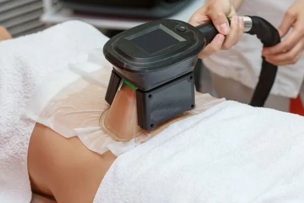 Image of person having fat freezing treatment to help weight gain Theale