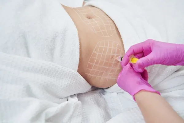 image of fat dissolving injections on love handles to help combat weight gain Theale