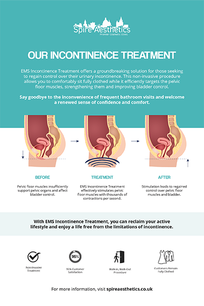 image to show how EMS treatment works for female urinary incontinence Theale