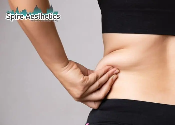 Image of woman pinching fat on their hips Theale. Fat Freezing treatment