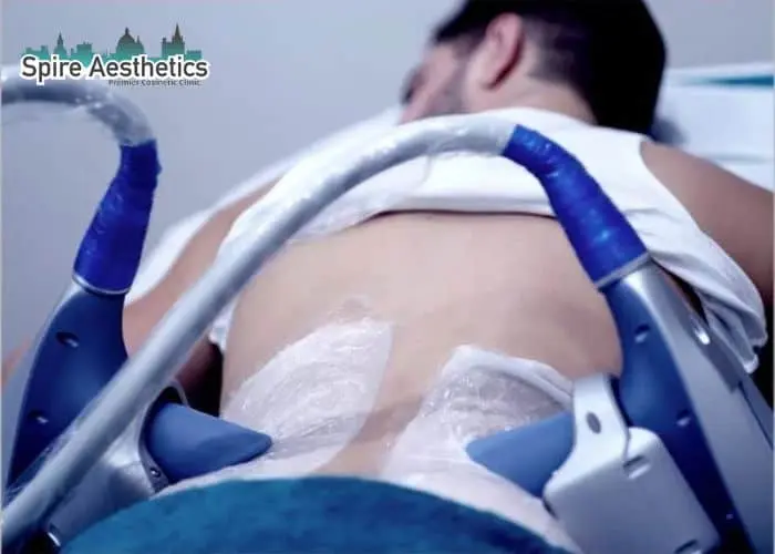 Man having fat freezing treatment done on love handles before a competitions Theale to create a sculpted look.