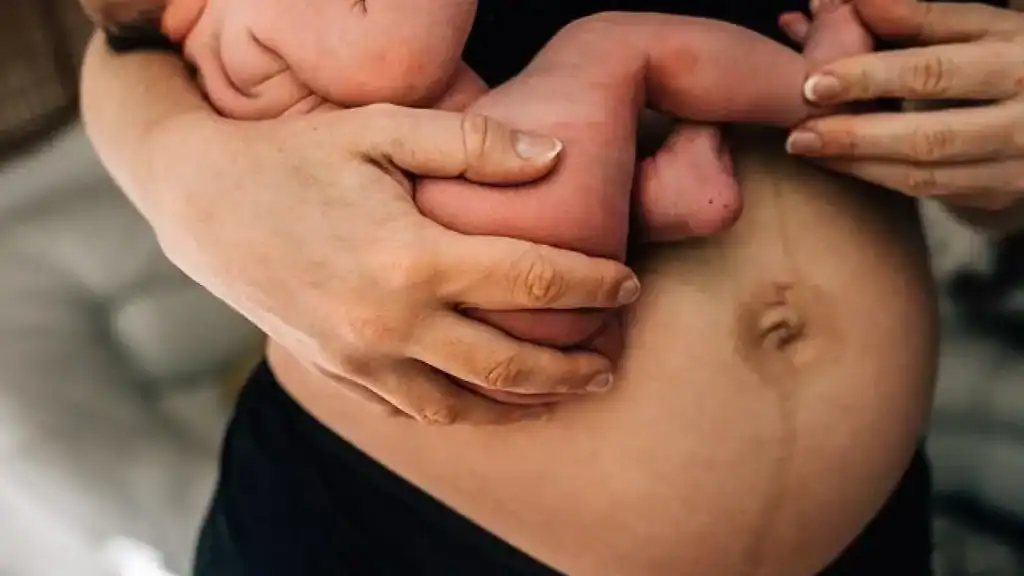 Why Is My Stomach Still Big After Pregnancy Theale?